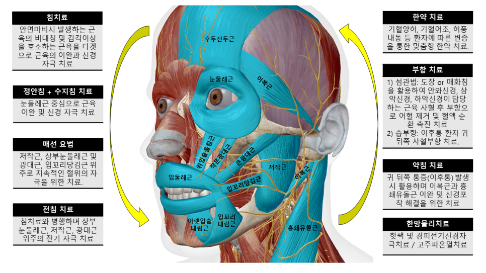 안면마비치료방법.png
