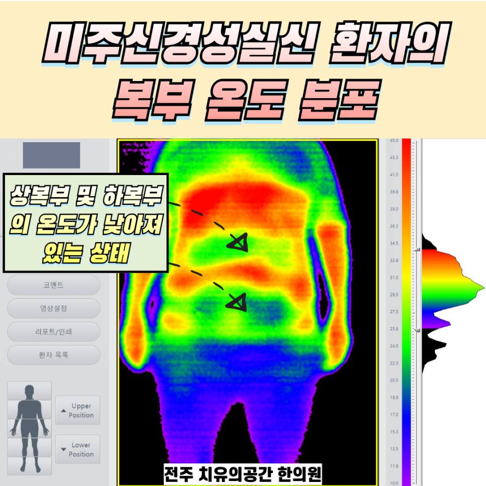 제목을-입력해주세요_-001_(3).png